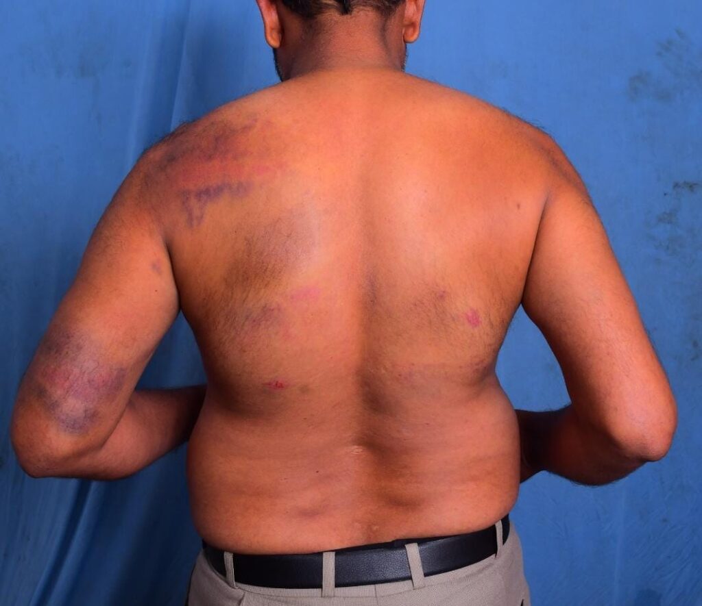 కోడేరు ఎస్సైని తక్షణమే సస్పెండ్ చేయాలి