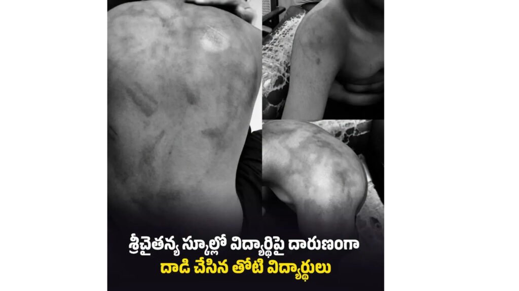 కర్రలతో కొట్టి బూట్లతో ముఖంపై తొక్కి…
